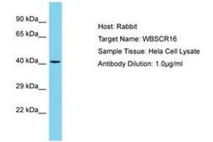 Image no. 1 for anti-Williams-Beuren Syndrome Chromosome Region 16 (WBSCR16) (AA 115-164) antibody (ABIN6750694) (WBSCR16 抗体  (AA 115-164))
