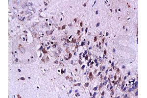 Formalin-fixed and paraffin embedded: rat brain tissue labeled with Anti-FasL Polyclonal Antibody, Unconjugated (ABIN726410) at 1:200, followed by conjugation to the secondary antibody and DAB staining