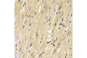 Immunohistochemistry of paraffin-embedded Mouse heart using TOPBP1 antibody at dilution of 1:100 (x40 lens). (TOPBP1 抗体)