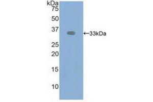 Western blot analysis of recombinant Human VEGFR2. (VEGFR2/CD309 抗体  (AA 46-320))