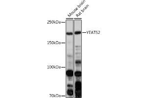 Western blot analysis of extracts of various cell lines, using YE antibody (ABIN7271413) at 1:1000 dilution. (YEATS2 抗体)
