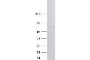 Validation with Western Blot (Paired Box 3 Protein (PAX3) (Myc-DYKDDDDK Tag))
