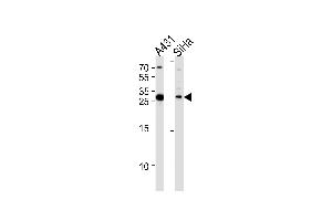 Western blot analysis in A431,SiHa cell line lysates (35ug/lane). (HSD17B12 抗体  (AA 126-155))