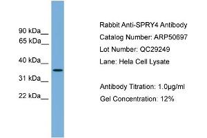 WB Suggested Anti-SPRY4  Antibody Titration: 0. (SPRY4 抗体  (Middle Region))