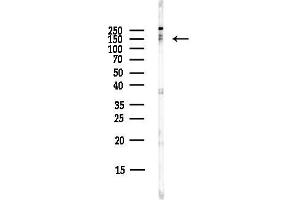 Western blot analysis of lysates from COLO205 cells(heat-shock,45 min treatment), using  Antibody at 1/1000 dilution.