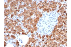 Immunohistochemistry (IHC) image for anti-Carboxypeptidase A1 (Pancreatic) (CPA1) antibody (ABIN6939174)