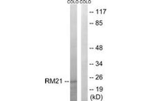 Western Blotting (WB) image for anti-Mitochondrial Ribosomal Protein L21 (MRPL21) (AA 131-180) antibody (ABIN2890052) (MRPL21 抗体  (AA 131-180))
