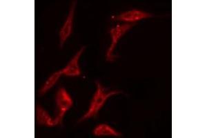 ABIN6269328 staining NIH-3T3 by IF/ICC. (PKC delta 抗体  (C-Term))