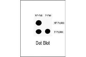 Dot blot analysis of anti-Phospho-P53-S9 Antibody (ABIN1881624 and ABIN2850450) on nitrocellulose membrane. (p53 抗体  (pSer9))