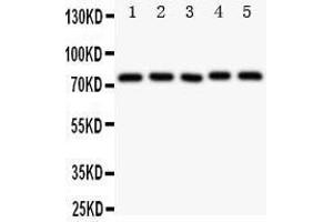 Western Blotting (WB) image for anti-Nuclear Receptor Subfamily 4, Group A, Member 3 (NR4A3) (AA 612-631), (C-Term) antibody (ABIN3044046)