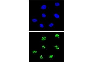 Confocal immunofluorescent analysis of TP73 Antibody (Center) (ABIN652829 and ABIN2842541) with 293 cell followed by Alexa Fluor® 488-conjugated goat anti-rabbit lgG (green). (Tumor Protein p73 抗体  (AA 288-317))