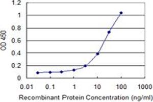 Detection limit for recombinant GST tagged MKNK1 is 0. (MKNK1 抗体  (AA 1-465))