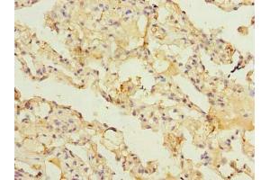 Immunohistochemistry of paraffin-embedded human lung tissue using ABIN7143477 at dilution of 1:100 (ARL11 抗体  (AA 2-196))