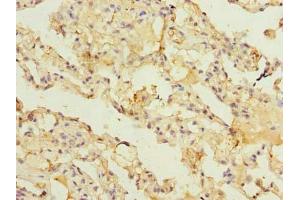 Immunohistochemistry of paraffin-embedded human lung tissue using ABIN7143477 at dilution of 1:100 (ARL11 抗体  (AA 2-196))