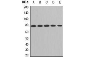 Western blot analysis of ACAS2 expression in HepG2 (A), SW620 (B), mouse liver (C), mouse kidney (D), rat brain (E) whole cell lysates. (ACSS2 抗体)