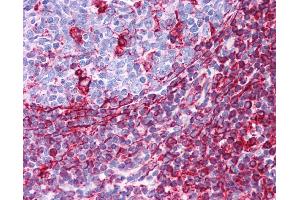 Vimentin antibody was used for immunohistochemistry at a concentration of 4-8 ug/ml. (Vimentin 抗体  (C-Term))