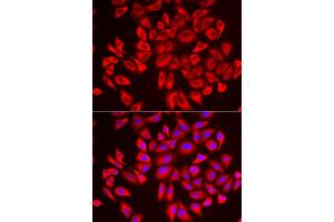 Immunofluorescence analysis of U2OS cell using DCAF7 antibody. (DCAF7 抗体)