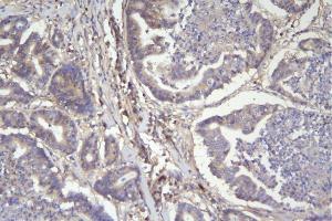 IHC analysis of CD46 using anti-CD46 antibody (ABIN7602758).