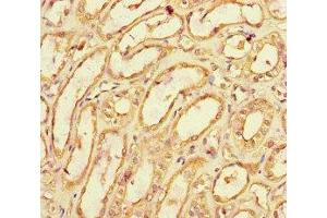 Immunohistochemistry (IHC) image for anti-Sparc/osteonectin, Cwcv and Kazal-Like Domains Proteoglycan (Testican) 1 (SPOCK1) (AA 290-435) antibody (ABIN7171790)
