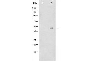 Western blot analysis of MEK2 phosphorylation expression in ovary cancer whole cell lysates,The lane on the left is treated with the antigen-specific peptide.