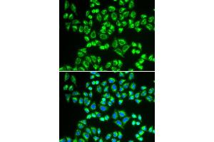 Immunofluorescence analysis of HeLa cell using SHMT2 antibody. (SHMT2 抗体)