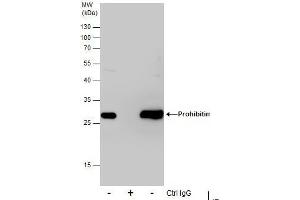 IP Image Immunoprecipitation of Prohibitin protein from 293T whole cell extracts using 5 μg of Prohibitin antibody, Western blot analysis was performed using Prohibitin antibody, EasyBlot anti-Rabbit IgG  was used as a secondary reagent. (Prohibitin 抗体)