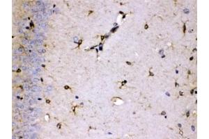 IHC testing of FFPE rat brain with ALDH7A1 antibody at 1ug/ml. (ALDH7A1 抗体  (AA 333-369))