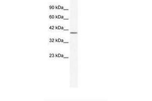 Image no. 1 for anti-Annexin A13 (ANXA13) (AA 62-111) antibody (ABIN203073) (Annexin A13 抗体  (AA 62-111))
