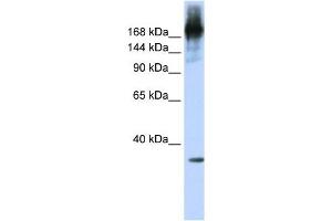 PRPF8 antibody used at 1 ug/ml to detect target protein.