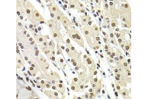 Immunohistochemistry (Paraffin-embedded Sections) (IHC (p)) image for anti-SRY (Sex Determining Region Y)-Box 5 (SOX5) antibody (ABIN7262915)