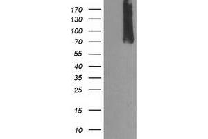 Western Blotting (WB) image for anti-Calpain 9 (CAPN9) antibody (ABIN1497092)