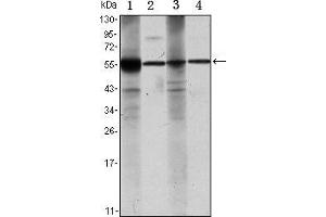 Western blot analysis using ALDH1A1 mouse mAb against Raji (1), Jurkat (2), THP-1 (3) and K562 (4) cell lysate. (ALDH1A1 抗体)