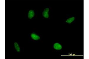 Immunofluorescence of purified MaxPab antibody to RAD51AP1 on HeLa cell. (RAD51AP1 抗体  (AA 1-335))