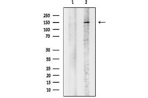 Western blot analysis of lysates from VERO cells(heat shock treatment), using KA/SRC1 Antibody.