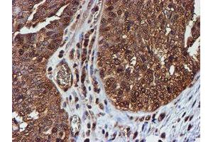 Image no. 16 for anti-Proteasome (Prosome, Macropain) Subunit, beta Type, 9 (Large Multifunctional Peptidase 2) (PSMB9) (AA 21-219) antibody (ABIN1491194)