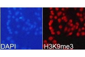 Immunofluorescence analysis of 293T cell using H3K9me3antibody.