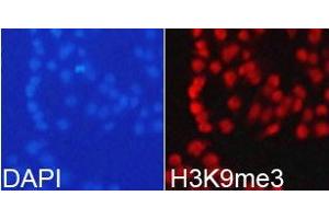 Immunofluorescence analysis of 293T cell using H3K9me3antibody. (Histone 3 抗体  (H3K9me3))