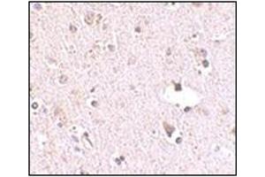 Immunohistochemistry (Paraffin-embedded Sections) (IHC (p)) image for anti-Polymerase (RNA) III (DNA Directed) Polypeptide F, 39 KDa (POLR3F) (N-Term) antibody (ABIN500523)