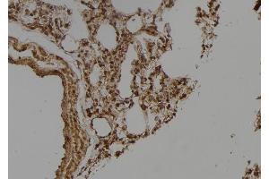 ABIN6275649 at 1/100 staining Rat lung tissue by IHC-P. (Ubiquilin 3 抗体  (Internal Region))