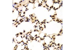 Immunohistochemistry (Paraffin-embedded Sections) (IHC (p)) image for anti-Histone 3 (H3) (H3K4me) antibody (ABIN3023251)