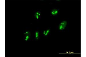 Immunofluorescence of purified MaxPab antibody to PARN on HeLa cell. (PARN 抗体  (AA 1-639))