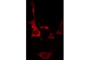 Immunofluorescence (fixed cells) (IF/ICC) image for anti-Solute Carrier Family 39 (Zinc Transporter), Member 1 (SLC39A1) (Internal Region) antibody (ABIN6258566)