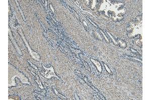 ABIN570714 (5 μg/mL) staining of paraffin embedded Human Prostate. (CEP290 抗体  (Internal Region))