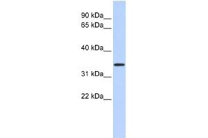 WB Suggested Anti-CCDC90A Antibody Titration:  0.