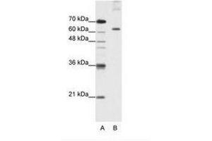 Image no. 2 for anti-Pumilio RNA Binding Family Member 3 (PUM3) (AA 61-110) antibody (ABIN203236) (KIAA0020 抗体  (AA 61-110))