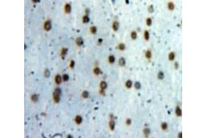 Used in DAB staining on fromalin fixed paraffin-embedded Brain tissue (TCEB3 抗体  (AA 200-344))