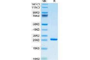 Human C-Reactive Protein /CRP on Tris-Bis PAGE under reduced condition. (CRP Protein (AA 19-224) (His tag))