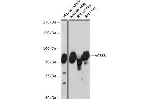 Western blot analysis of extracts of various cell lines, using  antibody (ABIN6131412, ABIN6136470, ABIN6136471 and ABIN6217898) at 1:3000 dilution. (ACSS3 抗体  (AA 30-280))