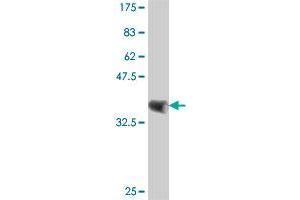 Western Blot detection against Immunogen (37 KDa) . (CSRP1 抗体  (AA 94-192))