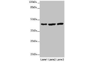 Western blot All lanes: MTERF4 antibody at 2 μg/mL Lane 1: Mouse kidney tissue Lane 2: HL60 whole cell lysate Lane 3: A549 whole cell lysate Secondary Goat polyclonal to rabbit IgG at 1/10000 dilution Predicted band size: 44 kDa Observed band size: 44 kDa (MTERFD2 抗体  (AA 45-87))